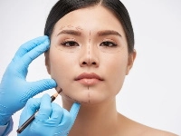 Lipofilling visage