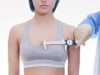 Augmentation mammaire par implants