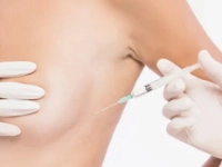 Lipofilling mammaire