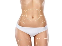 Abdominoplastie + Liposuccion ventre