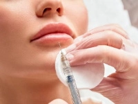Injections des lèvres