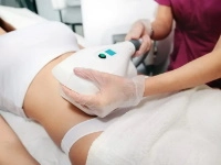 Coolsculpting