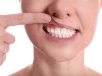 Chirurgie gingivale