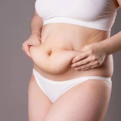 abdominoplastie_ abdominoplastie_