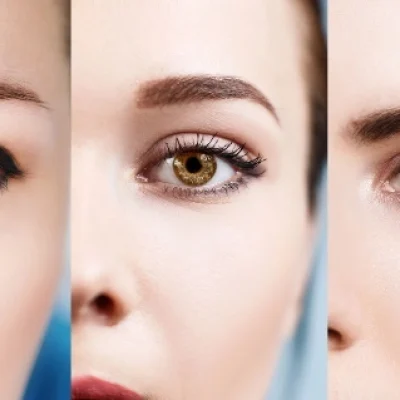 keratopigmentation_ keratopigmentation_