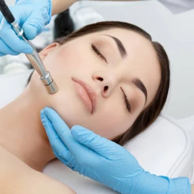 microdermabrasion__ microdermabrasion__